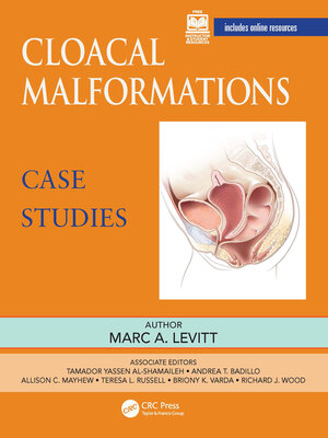 cover image of Cloacal Malformations